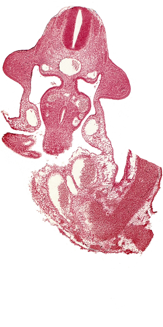 allantois, aorta, common umbilical vein, dermatomyotome 10 (C-6), dorsal mesentery, left umbilical artery, left umbilical vein, left vitelline (omphalomesenteric) vein, marginal layer, neural tube, postcardinal vein, right umbilical artery, right umbilical vein, umbilical cord, umbilical vesicle stalk, upper limb bud