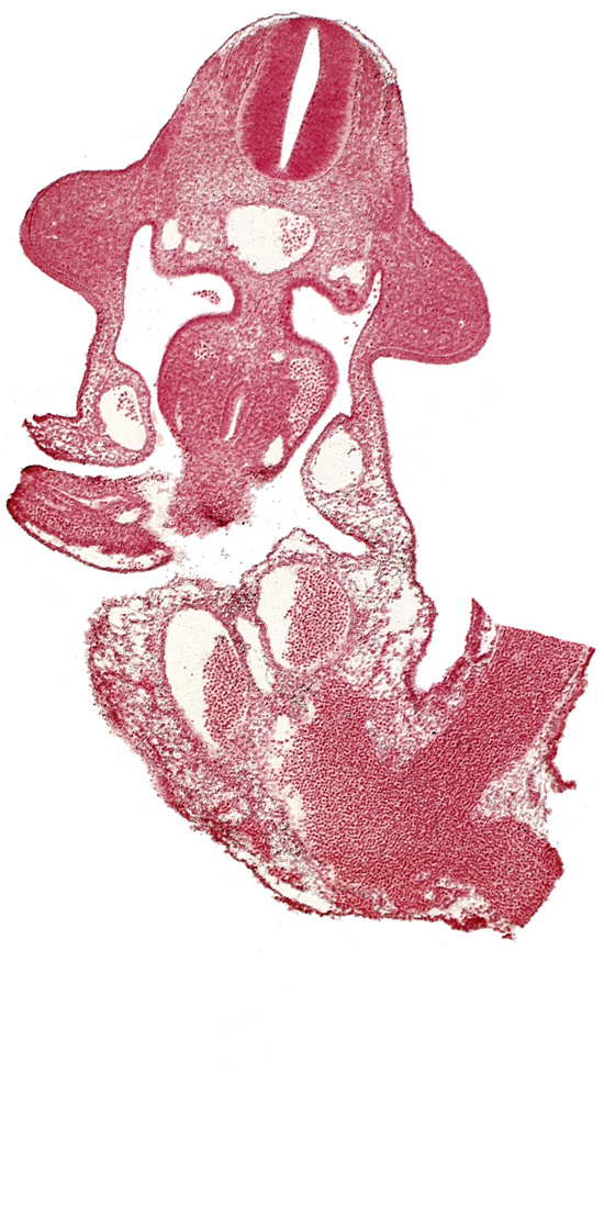 allantois, aorta, common umbilical vein, dermatomyotome 10 (C-6), dorsal mesentery, left umbilical artery, left umbilical vein, left vitelline (omphalomesenteric) vein, marginal layer, neural canal, postcardinal vein, right umbilical artery, right umbilical vein, subcardinal vein, umbilical vesicle stalk, upper limb bud