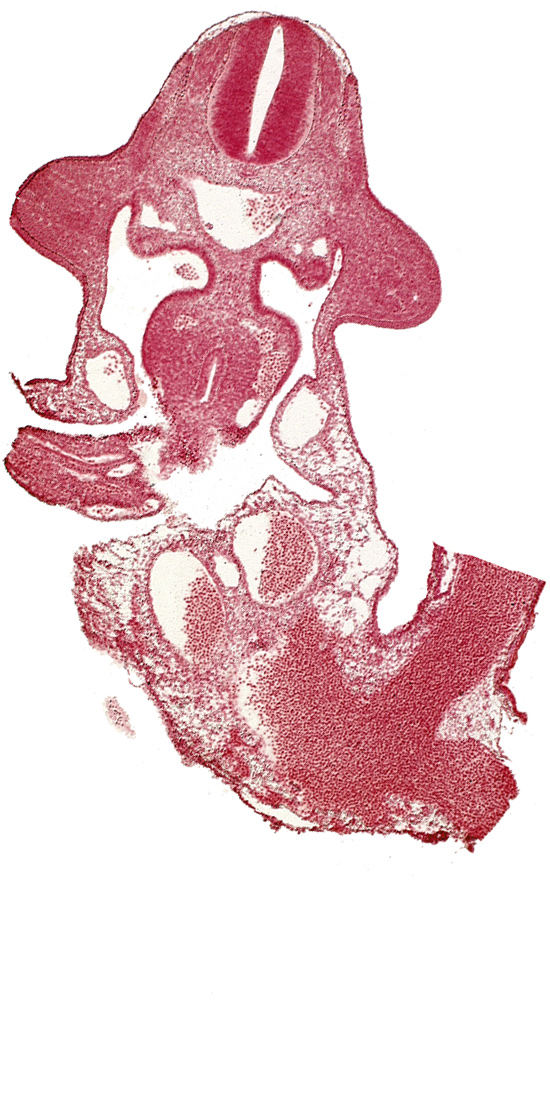 allantois, cephalic end of mesonephros, common umbilical vein, dermatomyotome 10 (C-6), dorsal mesentery, left umbilical artery, left umbilical vein, left vitelline (omphalomesenteric) vein, marginal layer, midgut, neural tube, omphaloenteric duct, postcardinal vein, right umbilical artery, right umbilical vein, subcardinal vein, upper limb bud