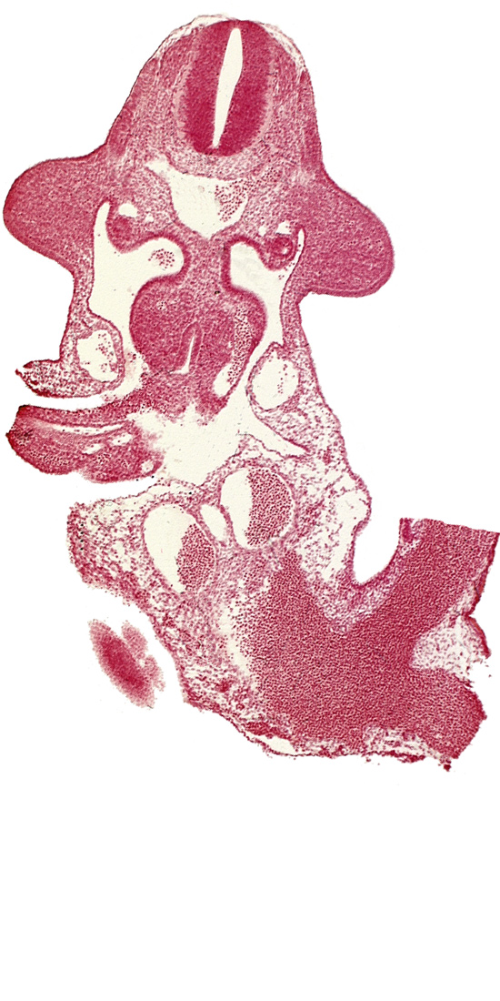 allantois, aorta, cephalic end of mesonephros, common umbilical vein, communication between coelomic cavity and extra-embryonic coelom, dermatomyotome 10 (C-6), edge of caudal eminence, intersegmental artery, left umbilical artery, left umbilical vein, left vitelline (omphalomesenteric) vein, midgut, omphaloenteric duct, postcardinal vein, subcardinal vein, upper limb bud