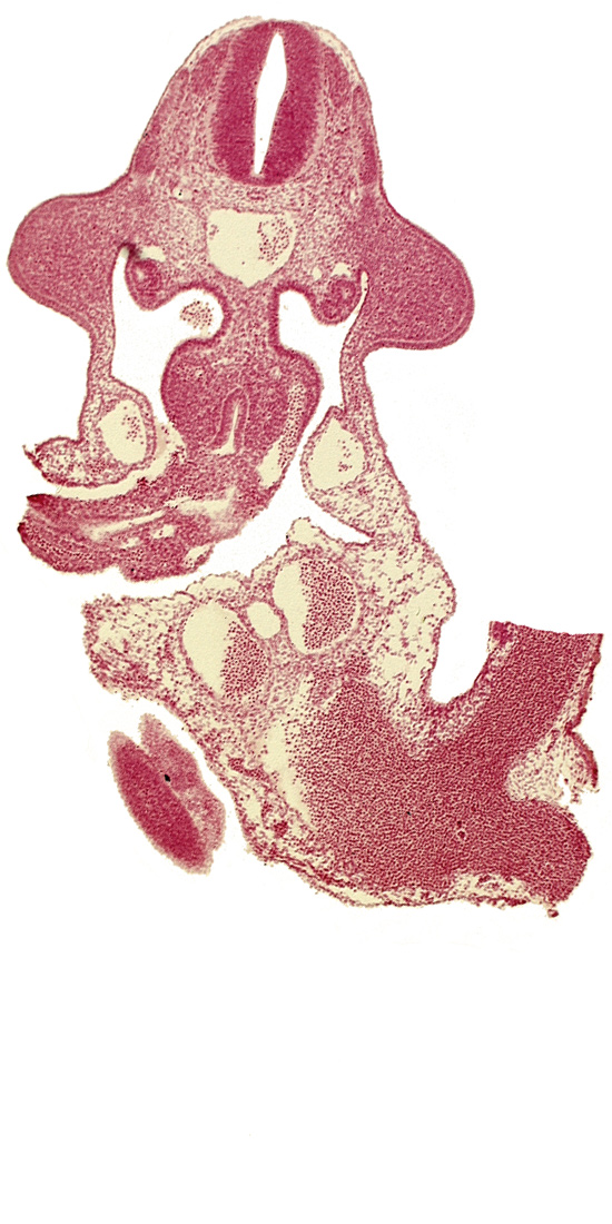 C-6 spinal ganglion primordium, allantois, aorta, cephalic end of mesonephros, cephalic limb bud mesenchyme, common umbilical vein, dermatomyotome 10 (C-6), edge of somite 32 (S-3), gonadal epithelium, left umbilical artery, left umbilical vein, marginal layer, mesonephric vesicle(s), midgut, omphaloenteric duct, origin of intersegmental artery, origin of vitelline (omphalomesenteric) artery, postcardinal vein, roof plate, subcardinal vein, sulcus limitans, vitelline (omphalomesenteric) vein