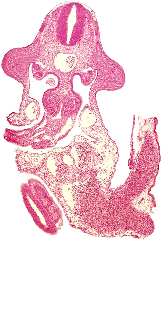 allantois, aorta, coelomic cavity, common umbilical vein, dermatomyotome 10 (C-6), edge of caudal eminence, gonadal epithelium, left umbilical artery, left umbilical vein, mesentery proper, neural canal, omphaloenteric duct, postcardinal vein, right umbilical vein, somite 31 (S-2), somite 32 (S-3), upper limb bud