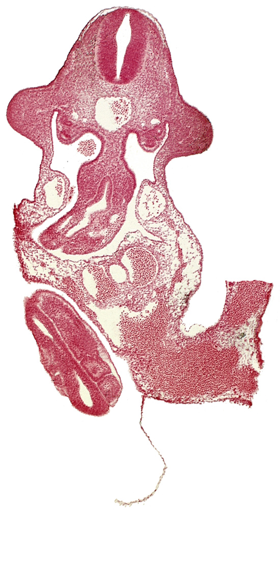 C-7 spinal ganglion primordium, aorta, junction of mesonephric duct and vesicle, junction of midgut and omphalo-enteric duct, left umbilical artery, left umbilical vein, mesentery proper, neural tube, paraxial mesoderm, right umbilical artery, right vitelline (omphalomesenteric) vein, somite 30 (S-1), somite 31 (S-2), somite 32 (S-3), sulcus limitans, upper limb bud