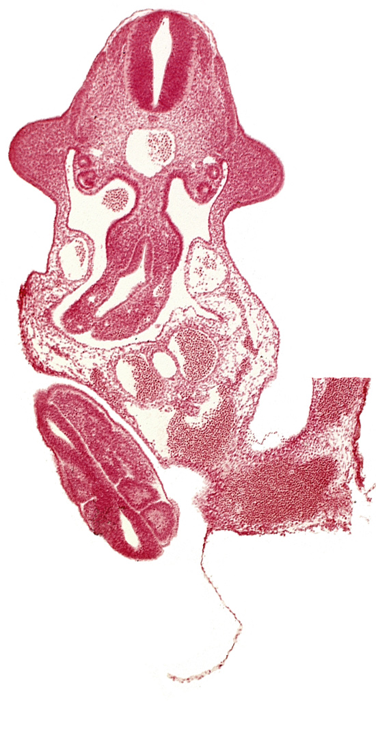allantois, aorta, coelomic cavity, dermatomyotome 11 (C-7), left umbilical artery, left umbilical vein, marginal layer, mesentery proper, neural tube, paraxial mesoderm, right umbilical artery, right umbilical vein, roof plate, somite 30 (S-1), somite 31 (S-2), somite 32 (S-3), sulcus limitans, upper limb bud