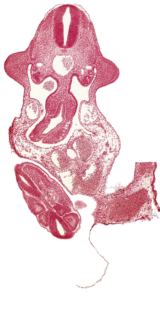 abdominal wall, alar plate(s), allantois, aorta, coelomic cavity, dermatomyotome 11 (C-7), junction of midgut and omphalo-enteric duct, neural tube, paraxial mesoderm, roof plate, somite 30 (S-1), somite 31 (S-2), somite 32 (S-3), sulcus limitans, upper limb bud