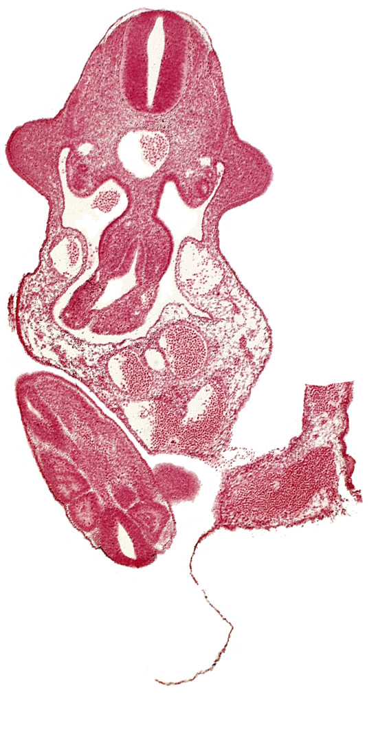 alar plate(s), allantois, aorta, basal plate, caudal plexus of veins, coelomic cavity, dermatomyotome 11 (C-7), junction of midgut and omphalo-enteric duct, neural canal, paraxial mesoderm, somite 30 (S-1), somite 31 (S-2), somite 32 (S-3), sulcus limitans, upper limb bud
