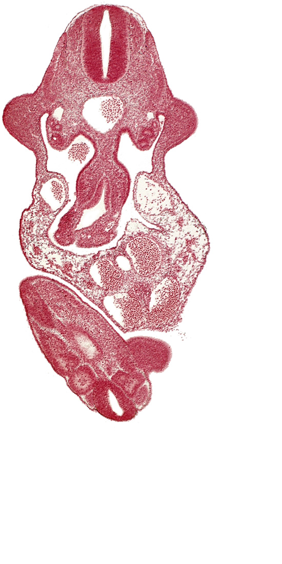 C-7 spinal ganglion primordium, aorta, caudal edge of cloaca, caudal eminence, caudal end of neural tube, coelomic cavity, dermatomyotome 11 (C-7), floor plate, junction of midgut and omphalo-enteric duct, left umbilical artery, left umbilical vein, lower limb bud, mesonephric duct, mesonephros, roof plate, somite 30 (S-1), somite 31 (S-2), sulcus limitans, upper limb bud