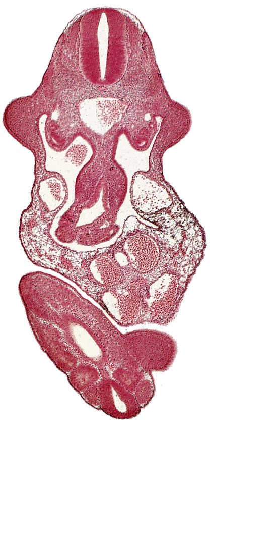 alar plate(s), aorta, basal plate, caudal edge of cloaca, caudal eminence, coelomic cavity, dermatomyotome 11 (C-7), left umbilical artery, left umbilical vein, lower limb bud, mesonephric duct, mesonephros, neural canal, notochord, somite 30 (S-1), somite 31 (S-2), sulcus limitans, upper limb bud