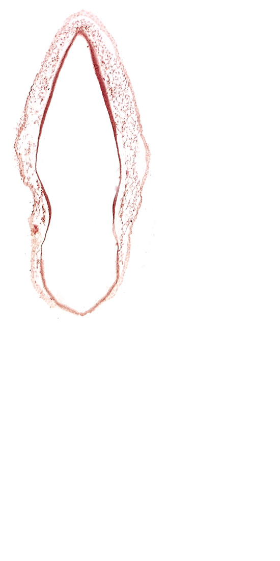 alar plate(s), head mesenchyme, rhombencoel (fourth ventricle), roof plate of rhombencephalon, surface ectoderm