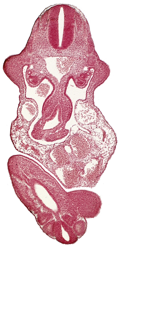 C-7 spinal ganglion primordium, allantois, aorta, caudal eminence, cloaca, dermatomyotome 11 (C-7), left umbilical artery, left umbilical vein, lower limb bud, mesonephric duct, mesonephric tubule(s), neural canal, notochord, origin of primary intestinal plexus artery, postcardinal vein, somite 29 (L-5), somite 30 (S-1), somite 31 (S-2), upper limb bud