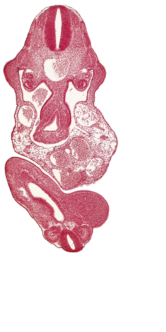 C-7 spinal ganglion primordium, abdominal wall, allantois, aorta, caudal eminence, cloaca, dermatomyotome 11 (C-7), dermatomyotome 12 (C-8), junction of midgut and omphalo-enteric duct, lower limb bud, mesonephric duct, neural tube, postcardinal vein, right umbilical artery, somite 29 (L-5), somite 30 (S-1), upper limb bud