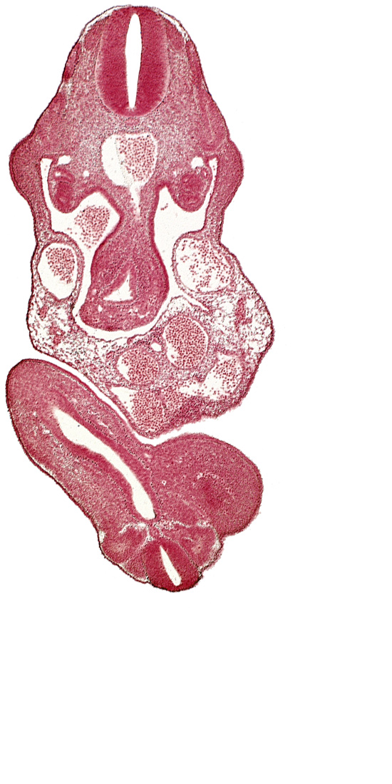 C-7 spinal ganglion primordium, allantois, aorta, cloaca, dermatomyotome 11 (C-7), dermatomyotome 12 (C-8), left umbilical artery, lower limb bud, mesonephric duct, midgut, neural canal, neural tube, postcardinal vein, primary intestinal plexus artery, right umbilical artery, right umbilical vein, somite 29 (L-5), somite 30 (S-1), subcardinal vein