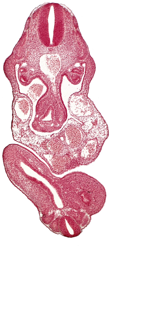 abdominal wall, aorta, dermatomyotome 11 (C-7), dermatomyotome 12 (C-8), edge of coelom, junction of cloaca and mesonephric duct, mesonephric duct, notochord, postcardinal vein, somite 29 (L-5), subcardinal vein