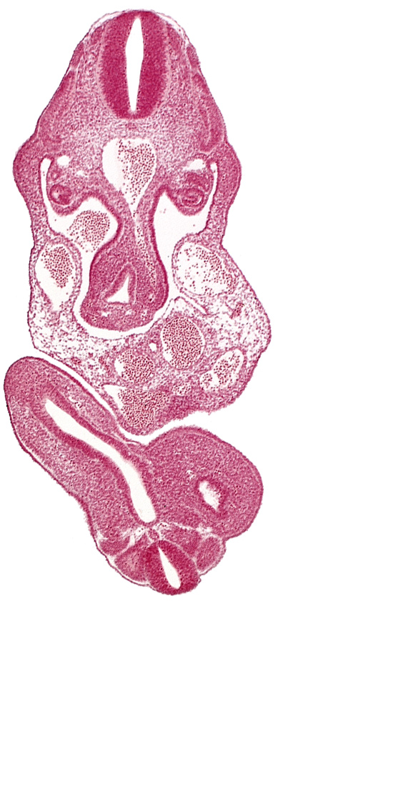 aorta, cloaca, dermatomyotome 11 (C-7), dermatomyotome 12 (C-8), junction of cloaca and mesonephric duct, mesonephric duct, notochord, postcardinal vein, somite 28 (L-4), somite 29 (L-5), subcardinal vein