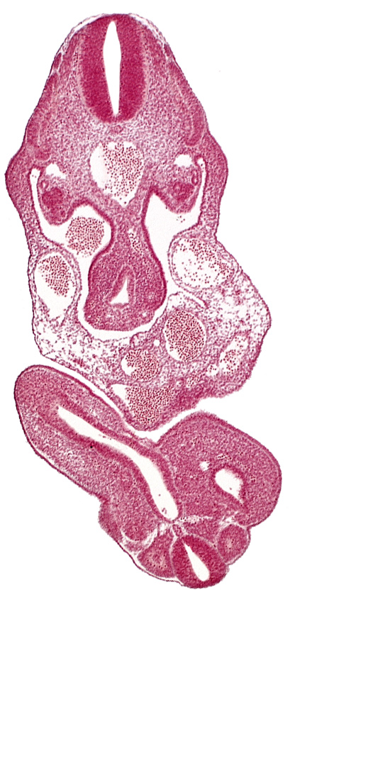 C-7 spinal ganglion primordium, cloaca, dermatomyotome 11 (C-7), dermatomyotome 12 (C-8), junction of cloaca and mesonephric duct, mesonephric duct, sclerotome, somite 28 (L-4), somite 29 (L-5)