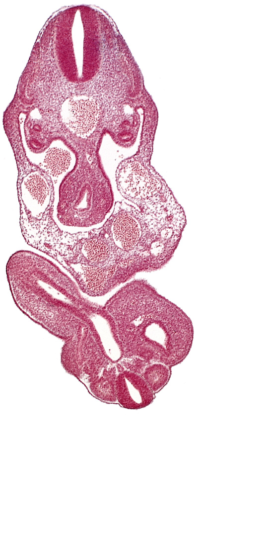 C-8 spinal ganglion primordium, caudal eminence, cloaca, coelom, dermatomyotome 12 (C-8), left umbilical artery, left umbilical vein, lower limb bud, mesonephric duct, mesonephric vesicle(s), notochord, right umbilical vein, somite 28 (L-4), tail gut