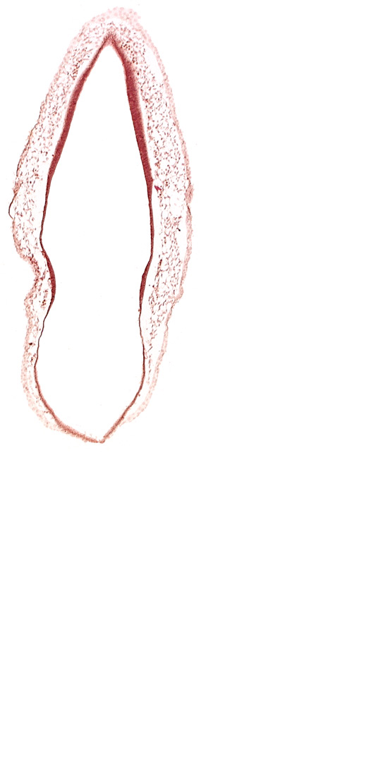 alar plate(s), head mesenchyme, rhombencoel (fourth ventricle), roof plate of rhombencephalon, surface ectoderm, venous plexus(es)