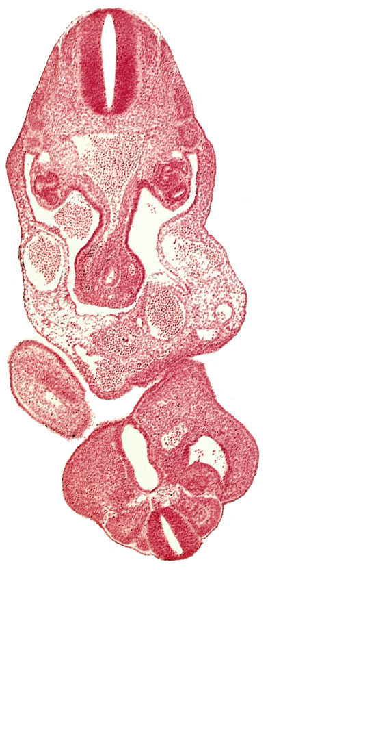 aorta, caudal eminence, cloaca, cloacal membrane, coelom, dermatomyotome 12 (C-8), dermatomyotome 13 (T-1), left umbilical artery, left umbilical vein, lower limb bud, primary intestinal plexus artery, right umbilical vein, somite 28 (L-4)