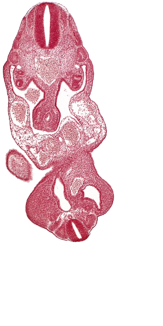 aorta, cloaca, coelom, dermatomyotome 13 (T-1), edge of caudal eminence, left umbilical artery, left umbilical vein, lower limb bud, notochord, right umbilical vein, somite 28 (L-4)