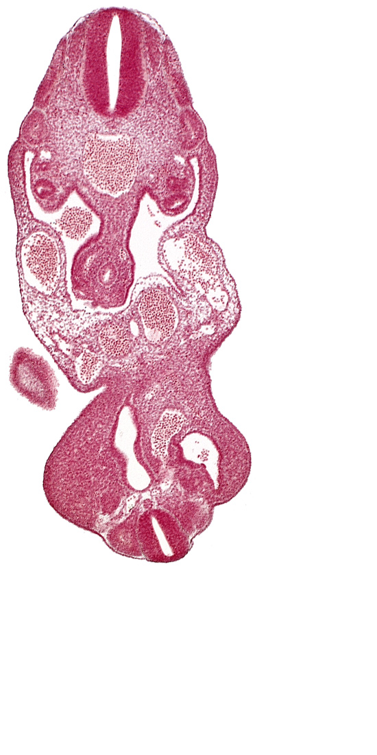 T-1 spinal ganglion primordium, aorta, cloaca, coelom, dermatomyotome 13 (T-1), edge of caudal eminence, left umbilical artery, left umbilical vein, lower limb bud, mesonephric duct, notochord, right umbilical vein