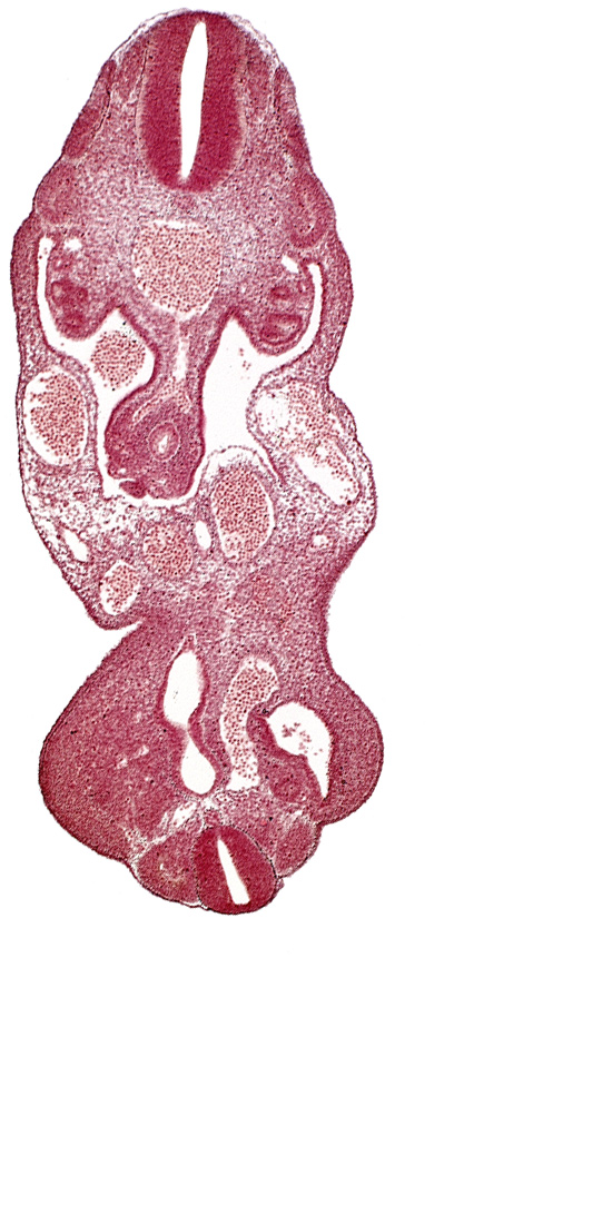 allantois, coelom, dermatomyotome 13 (T-1), left umbilical artery, left umbilical vein, lower limb bud, mesonephric duct, right umbilical artery, right umbilical vein