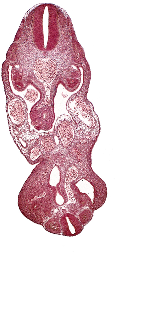 allantois, coelom, dermatomyotome 13 (T-1), dermatomyotome 27 (L-3), left umbilical artery, left umbilical vein, lower limb bud, notochord, rectum primordium, right umbilical artery, right umbilical vein, urogenital sinus, urorectal septum