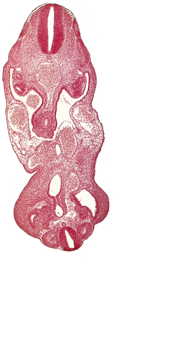 allantois, coelom, dermatomyotome 13 (T-1), dermatomyotome 27 (L-3), left common iliac artery, left umbilical artery, left umbilical vein, lower limb bud, mesonephric duct, notochord, rectum primordium, right umbilical vein, urogenital sinus, urorectal septum