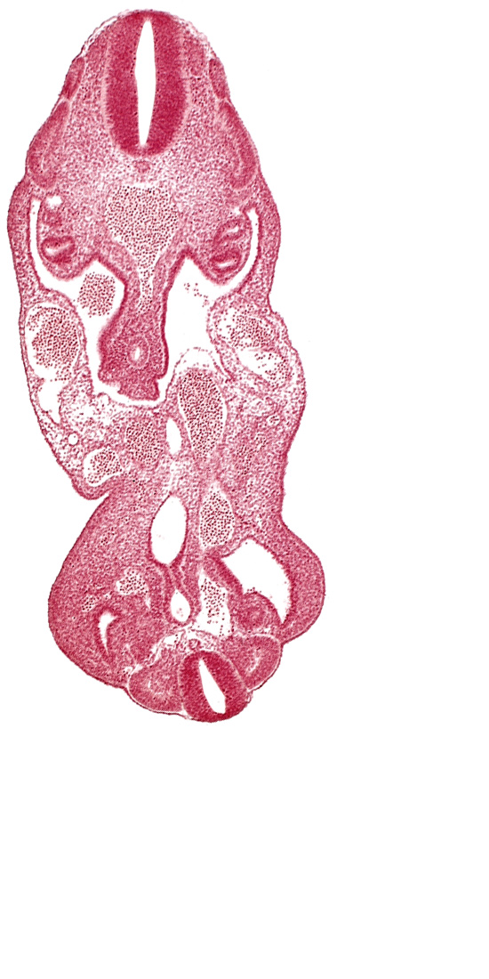 T-1 spinal ganglion primordium, allantois, aorta, coelom, dermatomyotome 13 (T-1), dermatomyotome 14 (T-2), dermatomyotome 27 (L-3), gonadal epithelium, hindgut, left common iliac artery, left umbilical artery, lower limb bud, mesonephric ridge, neural canal, notochord, origin of primary intestinal plexus artery, rectum primordium, sclerotome, urogenital sinus, urorectal septum