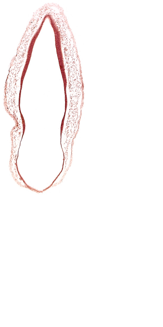 alar plate(s), roof plate of rhombencephalon