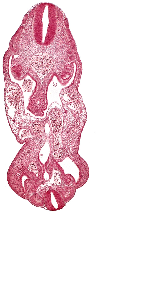 T-1 spinal ganglion primordium, aorta, coelom, dermatomyotome 13 (T-1), dermatomyotome 14 (T-2), dermatomyotome 27 (L-3), gonadal epithelium, hindgut, junction of allantois and urogenital sinus, left common iliac artery, left umbilical artery, lower limb bud, mesonephric ridge, neural canal, notochord, origin of primary intestinal plexus artery, rectum primordium, sclerotome, urogenital sinus, urorectal septum