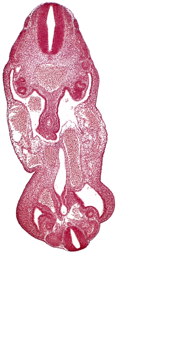 T-1 spinal ganglion primordium, aorta, coelom, dermatomyotome 14 (T-2), dermatomyotome 27 (L-3), gonadal epithelium, hindgut, left common iliac artery, left umbilical artery, lower limb bud, mesonephric ridge, neural canal, notochord, rectum primordium, urogenital sinus, urorectal septum