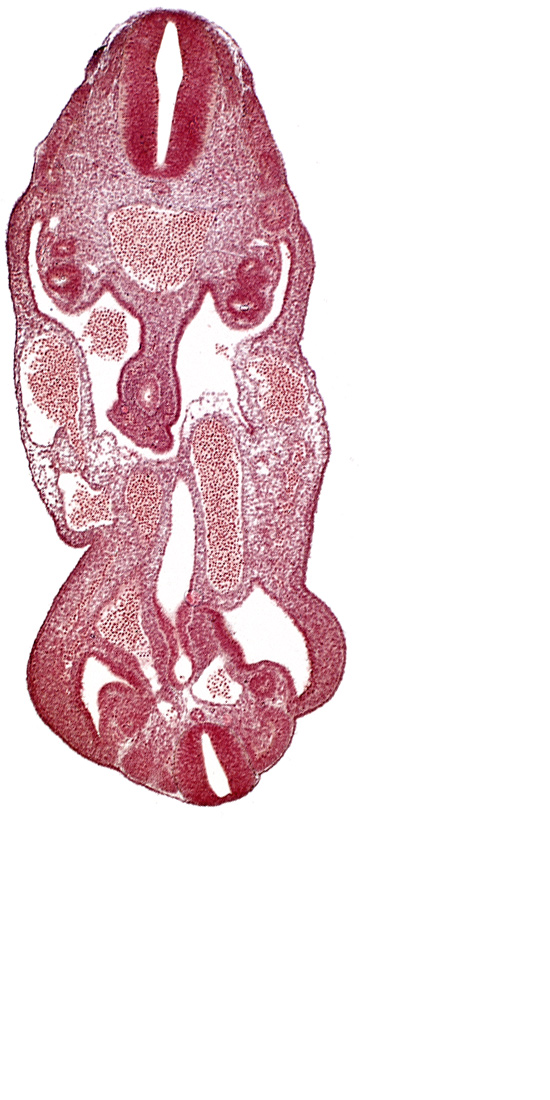 aorta, coelom, dermatomyotome 14 (T-2), dermatomyotome 27 (L-3), gonadal epithelium, hindgut, left common iliac artery, left umbilical artery, lower limb bud, mesonephric duct, mesonephric ridge, neural canal, notochord, rectum primordium, urogenital sinus, urorectal septum