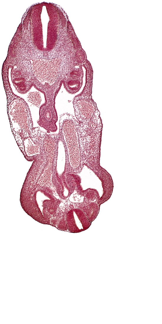 aorta, coelom, dermatomyotome 14 (T-2), dermatomyotome 27 (L-3), hindgut, left common iliac artery, left umbilical artery, mesonephric duct, neural canal, notochord, rectum primordium, right umbilical vein, urogenital sinus, urorectal septum