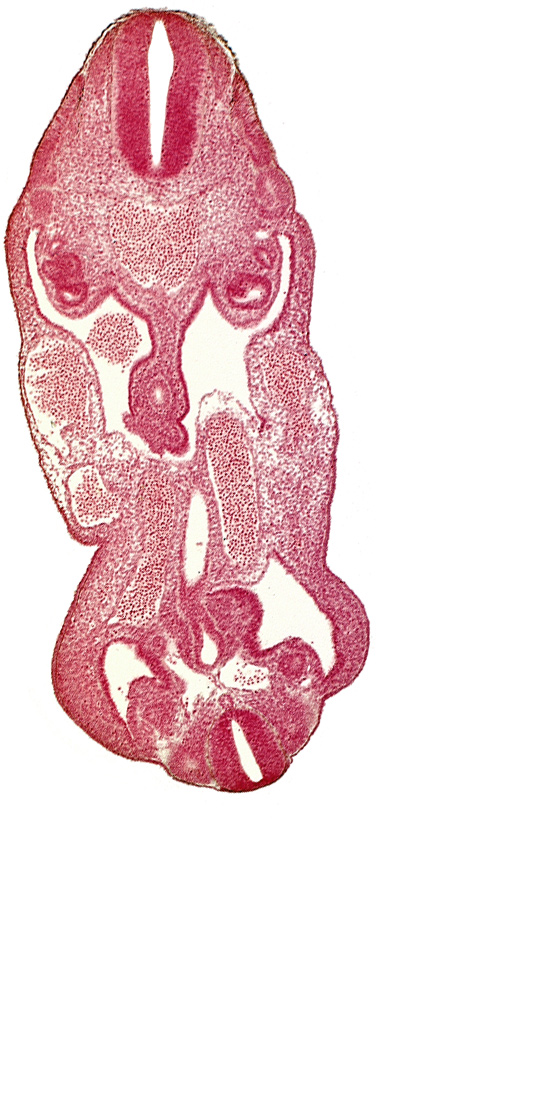 aorta, coelom, dermatomyotome 14 (T-2), dermatomyotome 27 (L-3), hindgut, left common iliac artery, left umbilical artery, neural canal, notochord, rectum primordium, right umbilical vein, urogenital sinus, urorectal septum