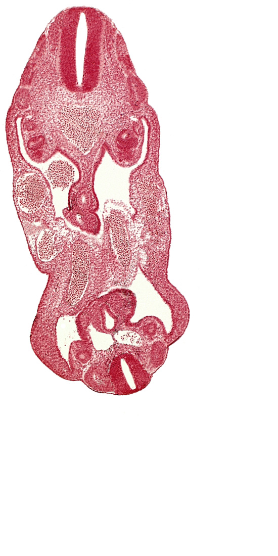 aorta, coelom, dermatomyotome 14 (T-2), dermatomyotome 26 (L-2), hindgut, left common iliac artery, left umbilical artery, mesonephric duct, neural canal, right common iliac artery, right umbilical artery, right umbilical vein