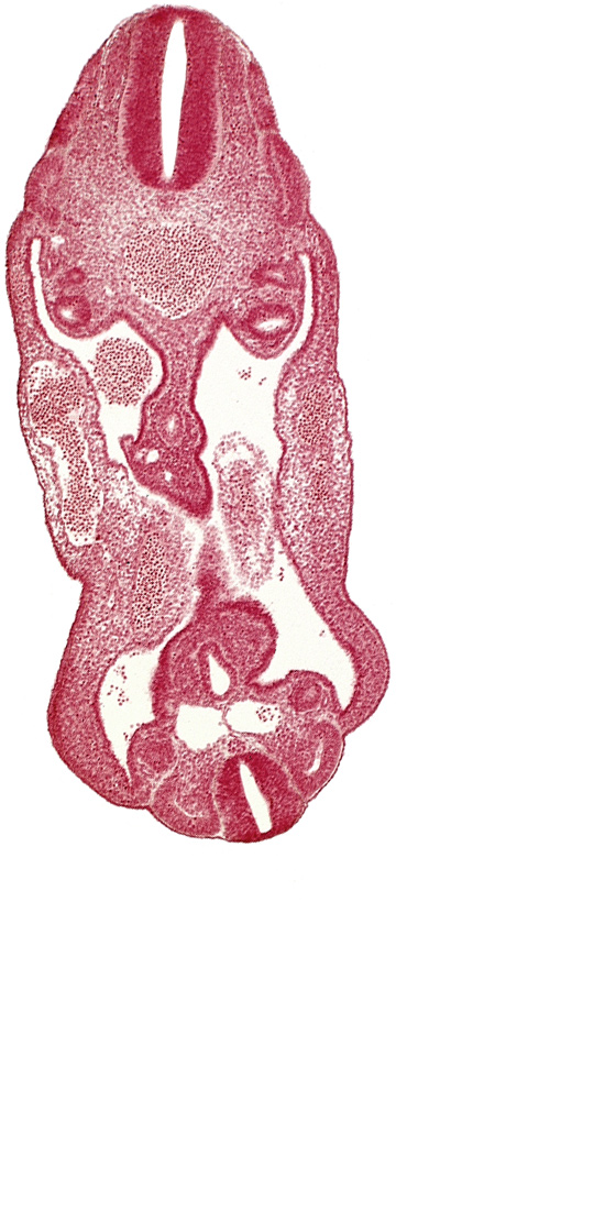 aorta, coelom, dermatomyotome 14 (T-2), dermatomyotome 15 (T-3), dermatomyotome 26 (L-2), hindgut, left common iliac artery, mesentery, mesonephric duct, mesonephric vesicle(s), neural canal, neural tube, right common iliac artery, sclerotome