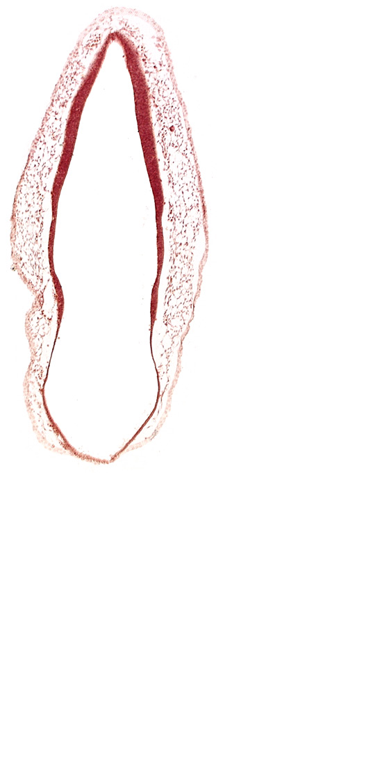 alar plate of rhombencephalon, head mesenchyme, rhombencoel (fourth ventricle), roof plate of rhombencephalon, surface ectoderm