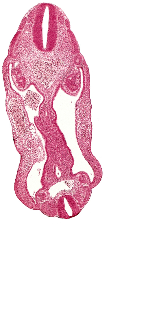 aorta, aortic bifurcation, coelom, dermatomyotome 14 (T-2), dermatomyotome 15 (T-3), dermatomyotome 26 (L-2), hindgut, mesentery, neural tube, sclerotome