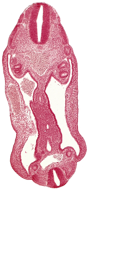 aorta, aortic bifurcation, coelom, dermatomyotome 15 (T-3), dermatomyotome 26 (L-2), hindgut, mesentery, neural tube, notochord