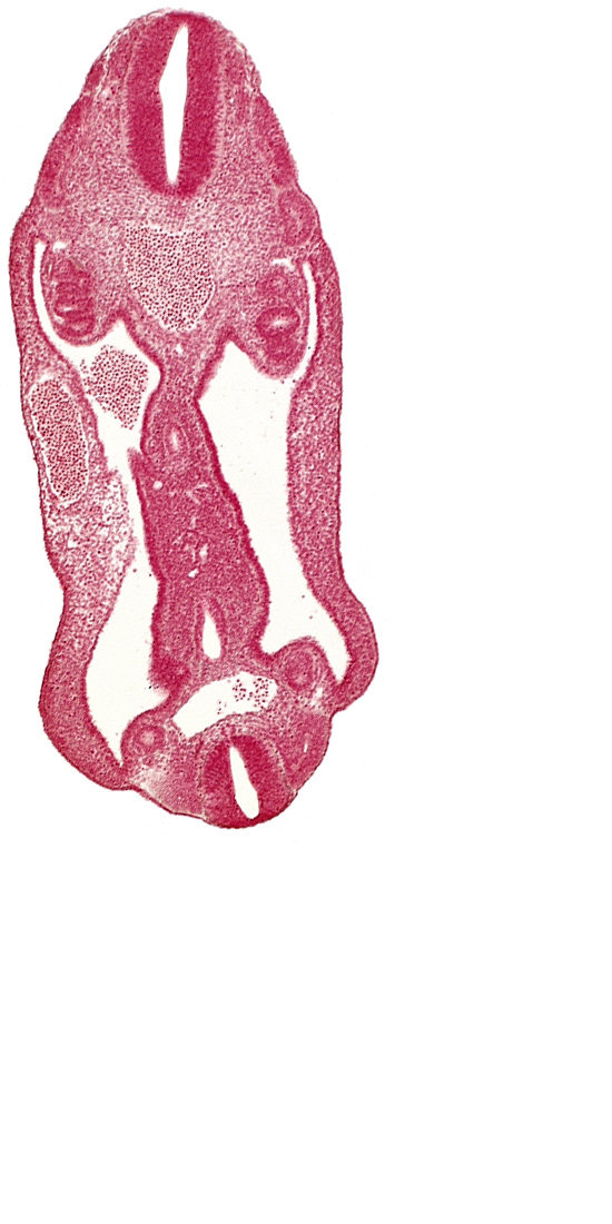 aorta, aortic bifurcation, coelom, dermatomyotome 15 (T-3), dermatomyotome 26 (L-2), hindgut, mesentery, neural tube, notochord