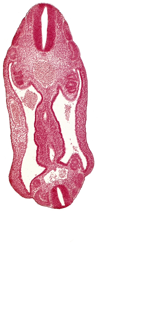 aorta, aortic bifurcation, coelom, dermatomyotome 15 (T-3), dermatomyotome 16 (T-4), dermatomyotome 25 (L-1), dermatomyotome 26 (L-2), hindgut, mesentery, neural tube, notochord