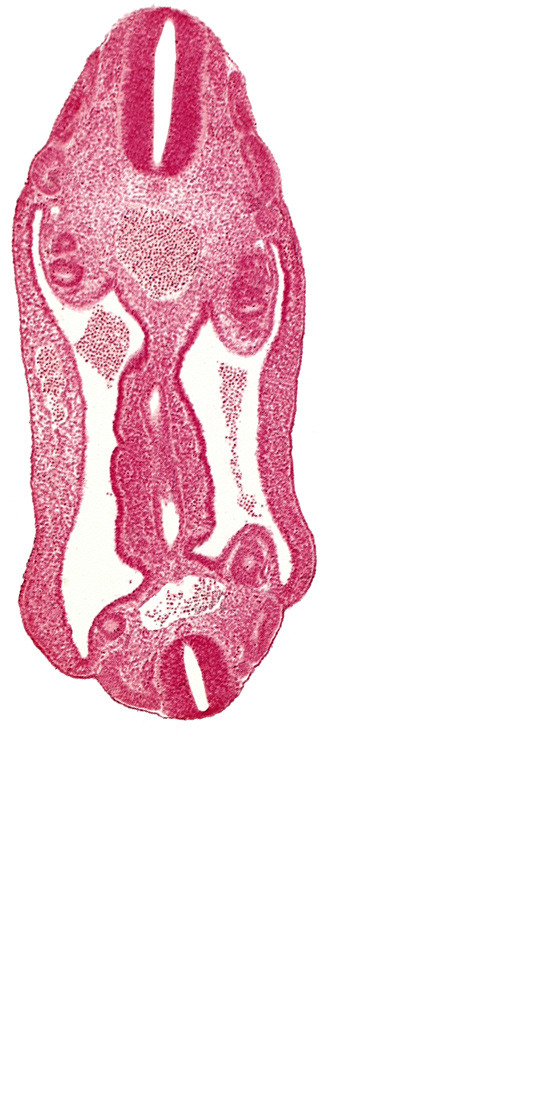 T-3 spinal ganglion primordium, aorta, aortic bifurcation, coelom, continuity of hindgut, dermatomyotome 15 (T-3), dermatomyotome 16 (T-4), dermatomyotome 25 (L-1), hindgut, mesentery, mesonephric duct, neural tube, sclerotome