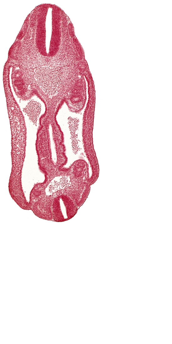 aorta, dermatomyotome 15 (T-3), dermatomyotome 16 (T-4), dermatomyotome 17 (T-5), dermatomyotome 25 (L-1), hindgut, mesentery, mesonephros, neural tube