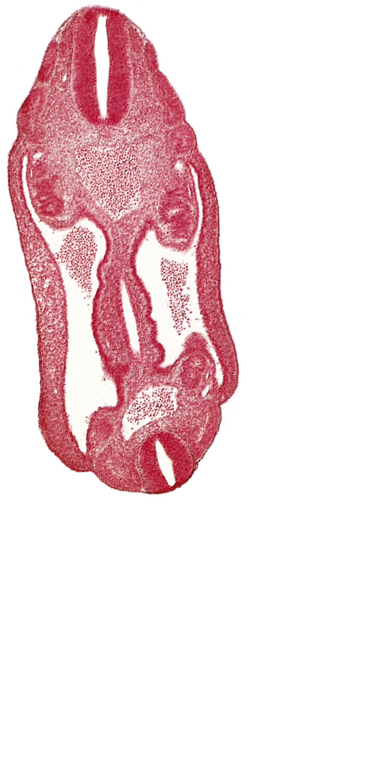 aorta, coelom, dermatomyotome 15 (T-3), dermatomyotome 16 (T-4), dermatomyotome 17 (T-5), dermatomyotome 25 (L-1), hindgut endoderm, mesothelium, neural tube, sclerotome, somatic mesoderm, splanchnic mesoderm, surface ectoderm