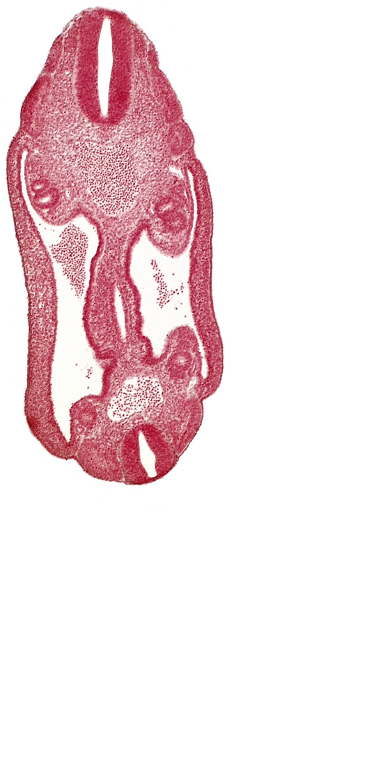 aorta, coelom, dermatomyotome 15 (T-3), dermatomyotome 16 (T-4), dermatomyotome 17 (T-5), dermatomyotome 25 (L-1), mesothelium, neural tube, sclerotome, somatic mesoderm, splanchnic mesoderm