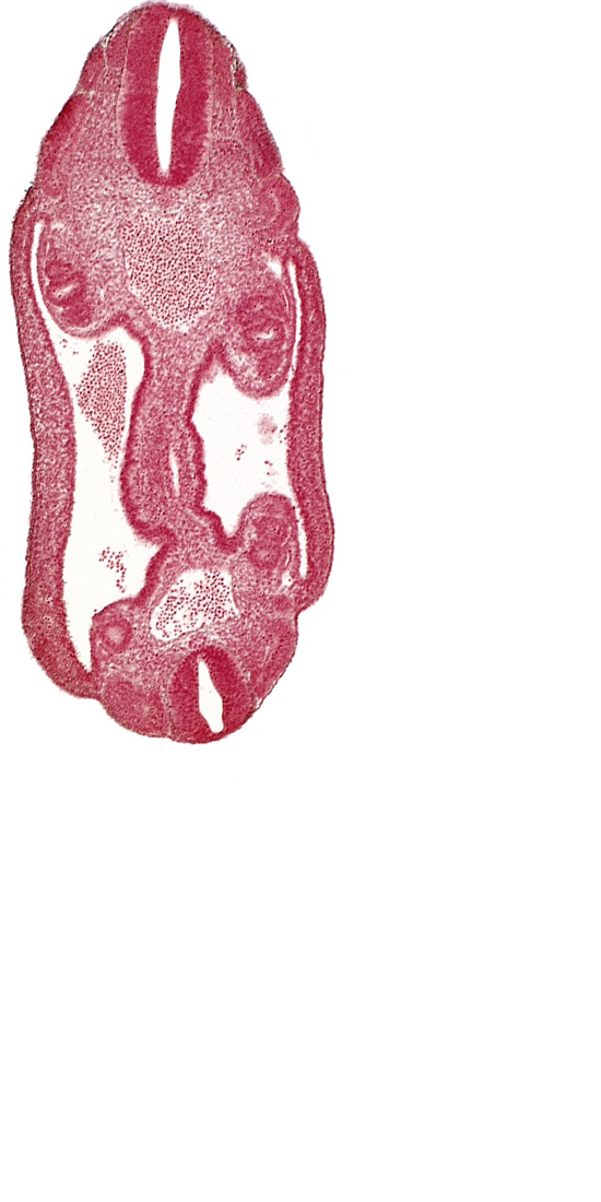 aorta, coelom, dermatomyotome 16 (T-4), dermatomyotome 17 (T-5), dermatomyotome 25 (L-1), mesonephric duct, mesothelium, neural tube, notochord, sclerotome, somatic mesoderm, splanchnic mesoderm