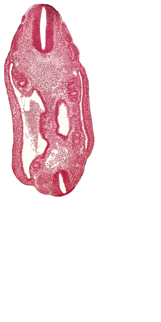 aorta, coelom, dermatomyotome 16 (T-4), dermatomyotome 17 (T-5), dermatomyotome 24 (T-12), dermatomyotome 25 (L-1), lateral body wall, mesonephric vesicle(s), mesothelium, neural tube, notochord, roof plate of neural tube, somatic mesoderm, splanchnic mesoderm