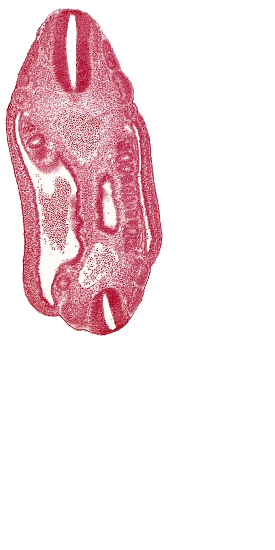 aorta, coelom, dermatomyotome 16 (T-4), dermatomyotome 17 (T-5), dermatomyotome 18 (T-6), dermatomyotome 24 (T-12), dermatomyotome 25 (L-1), dorsal mesentery, lateral body wall, mesonephric vesicle(s), mesothelium, neural tube, notochord, roof plate of neural tube