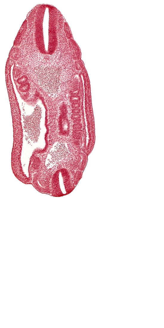 aorta, dermatomyotome 16 (T-4), dermatomyotome 17 (T-5), dermatomyotome 18 (T-6), dermatomyotome 24 (T-12), dermatomyotome 25 (L-1), lateral body wall, mesonephric ridge, mesonephric vesicle(s), neural tube, roof plate of neural tube