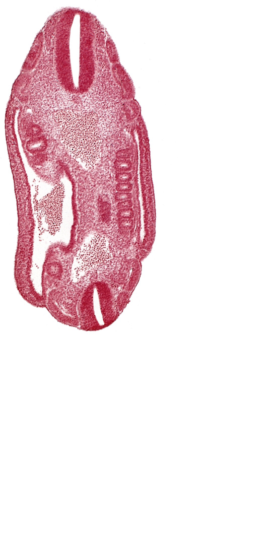 aorta, dermatomyotome 16 (T-4), dermatomyotome 17 (T-5), dermatomyotome 18 (T-6), dermatomyotome 24 (T-12), dermatomyotome 25 (L-1), lateral body wall, mesonephric duct, mesonephric ridge, mesonephric vesicle(s), neural tube, roof plate of neural tube
